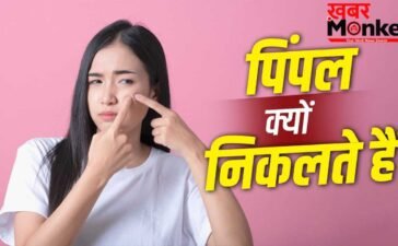 पसीना या ऑयल ही नहीं….इन 5 वजहों से भी निकलते हैं चेहरे पर पिंपल