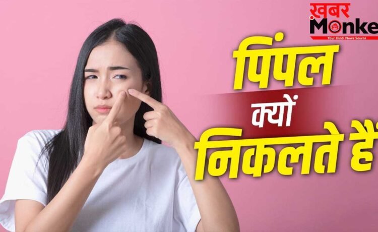 पसीना या ऑयल ही नहीं….इन 5 वजहों से भी निकलते हैं चेहरे पर पिंपल
