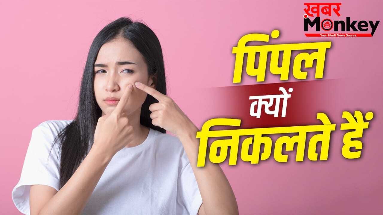 पसीना या ऑयल ही नहीं….इन 5 वजहों से भी निकलते हैं चेहरे पर पिंपल
