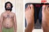 Weight Loss Transformation: शख्स ने वजन घटाने के लिए अपनाया अनोखा तरीका, 5 दिन तक नहीं खाया खाना, चौंकाने वाला आया रिजल्ट