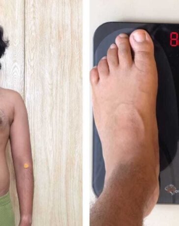 Weight Loss Transformation: शख्स ने वजन घटाने के लिए अपनाया अनोखा तरीका, 5 दिन तक नहीं खाया खाना, चौंकाने वाला आया रिजल्ट
