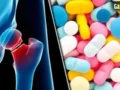 Vitamin D Supplements: क्या आपकी हड्डियां सिर्फ सप्लीमेंट्स के भरोसे हैं? जानिए एक्सपर्ट की राय​