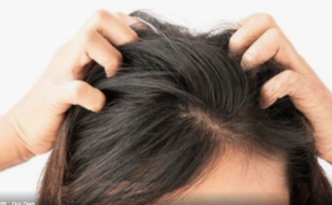 सिर की जूं ने ले ली 12 साल की लक्ष्मीप्रिया की जान, बेटी ने इतना दर्द सहा कि कोई नहीं कर पाएगा यकीन