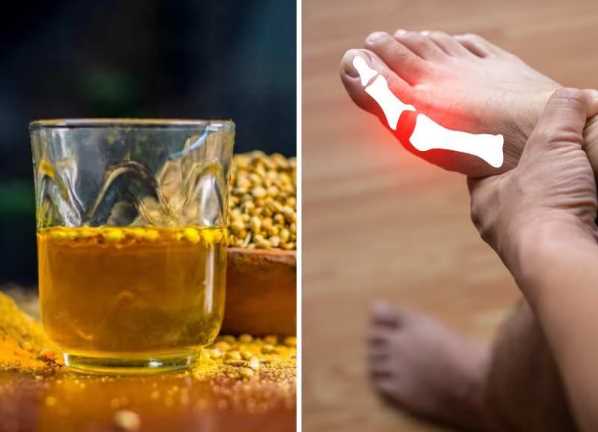 यूरिक एसिड लेवल कम करने के लिए पी लो ये 5 देसी ड्रिंक्स, दवा की नहीं पड़ेगी जरूरत! “ >.