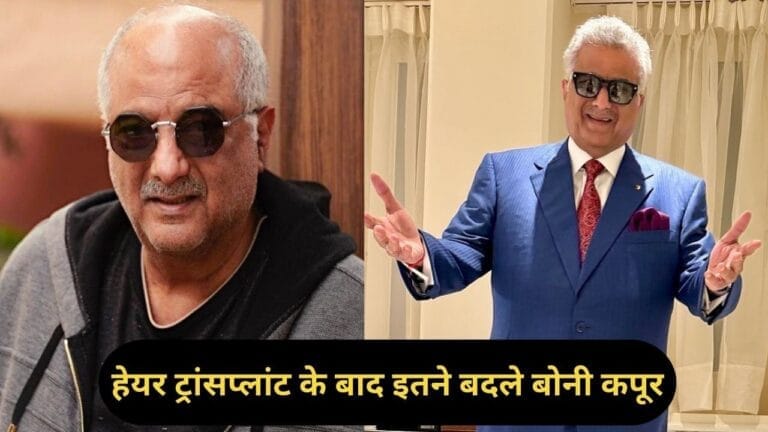 गंजे बहुत अमीर होते हैंबोनी कपूर ने हेयर ट्रांसप्लांट से पहले क्यों कम किया 14 KG वजन? “ • ˌ गंजे बहुत अमीर होते हैंबोनी कपूर ने हेयर ट्रांसप्लांट से पहले क्यों कम किया 14 KG वजन? “ • ˌ