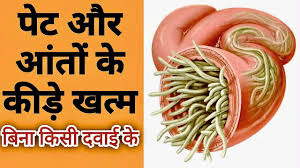 पेट के कीड़े मारने के असरदार घरेलू आयुर्वेदिक नुस्खे पेट के कीड़े मारने के असरदार घरेलू आयुर्वेदिक नुस्खे