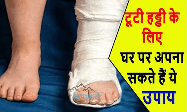हड्डी टूटने पर आप भी अपने घर पर अपना सकते हैं ये उपाय, जल्द मिलेगा आराम!! “ • ˌ हड्डी टूटने पर आप भी अपने घर पर अपना सकते हैं ये उपाय, जल्द मिलेगा आराम!! “ • ˌ