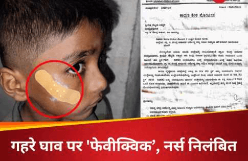 गाल में गहरा घाव, नर्स ने टांके की जगह लगा दिया ‘फेवीक्विक’, मचा हड़कंप !·! “ • ˌ गाल में गहरा घाव, नर्स ने टांके की जगह लगा दिया ‘फेवीक्विक’, मचा हड़कंप !·! “ • ˌ